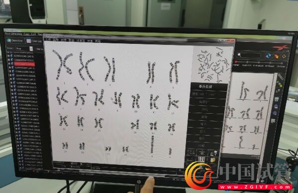 詳解染色體易位的三種類型，引起原因除輻射外還有...(圖1)