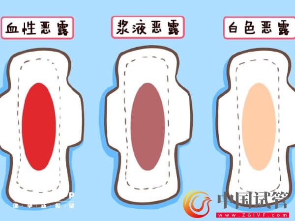 盤點(diǎn)產(chǎn)后惡露會(huì)有幾種顏色,出現(xiàn)黑色就需注意了!(圖1) 盤點(diǎn)產(chǎn)后惡露會(huì)有幾種顏色,出現(xiàn)黑色就需注意了!(圖1)