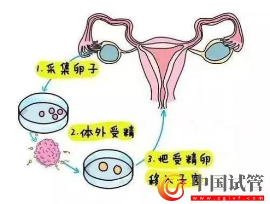 新一代試管嬰兒技術(shù)發(fā)布!專家:每年可多生10萬以上嬰兒(圖3) 新一代試管嬰兒技術(shù)發(fā)布!專家:每年可多生10萬以上嬰兒(圖3)