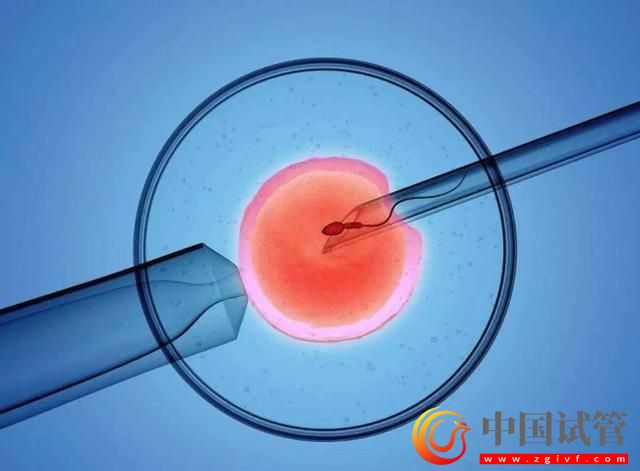 去磨丁做試管嬰兒需要注意些什么(圖1)