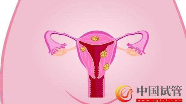 北京宮頸癌與乳腺癌早診治療率接近100%(圖1) 北京宮頸癌與乳腺癌早診治療率接近100%(圖1)