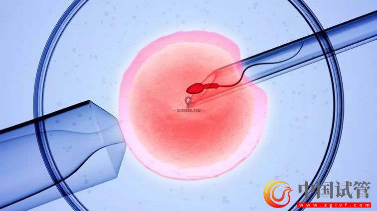 海南藏族自治州哪做第三代試管嬰兒?(圖1) 海南藏族自治州哪做第三代試管嬰兒?(圖1)