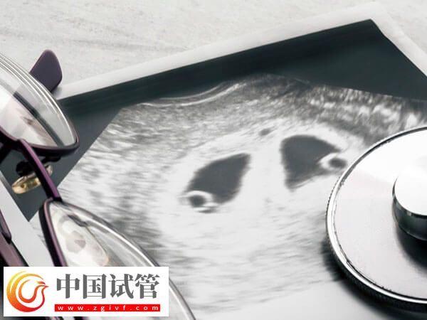 殘角子宮助孕選成都哪家醫院好？對比成功率選更放心(圖2)