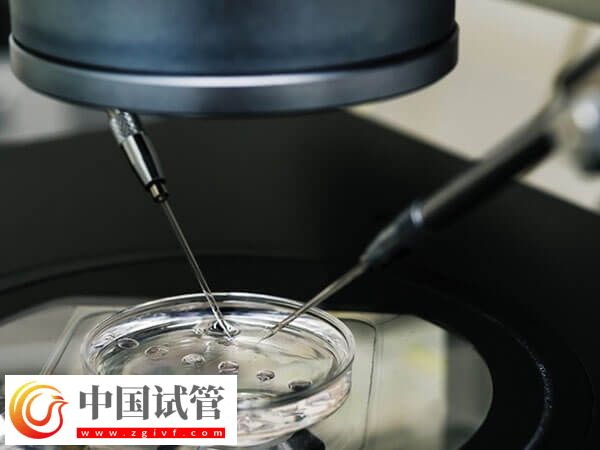 綿陽市中心醫(yī)院助孕全程開銷匯總,檢查到手術(shù)至少3w(圖1) 綿陽市中心醫(yī)院助孕全程開銷匯總,檢查到手術(shù)至少3w(圖1)