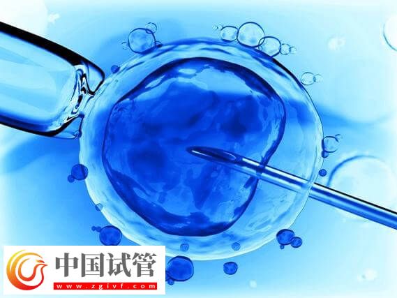 阜新細河區(qū)試管嬰兒哪家比較好呢?(圖1) 阜新細河區(qū)試管嬰兒哪家比較好呢?(圖1)