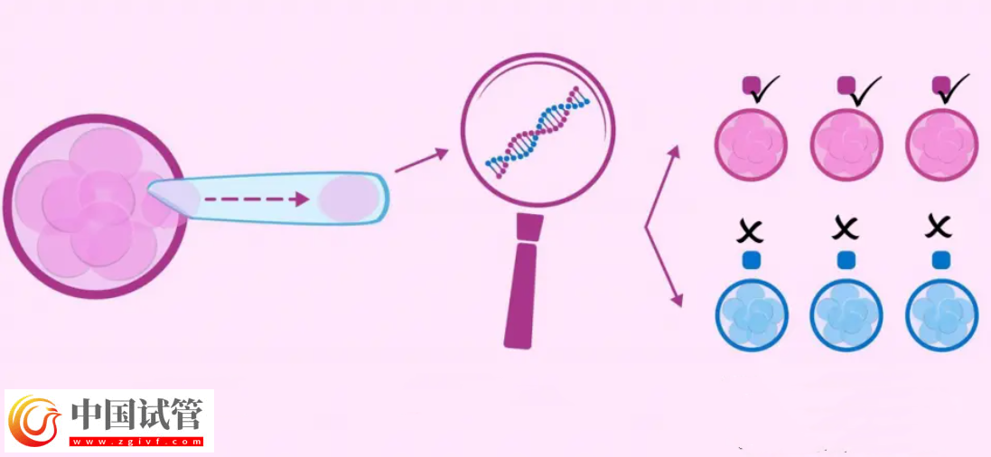囊胚等級與寶寶健康之間有關系嗎?(圖1) 囊胚等級與寶寶健康之間有關系嗎?(圖1)