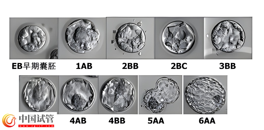 囊胚等級與寶寶健康之間有關系嗎?(圖3) 囊胚等級與寶寶健康之間有關系嗎?(圖3)