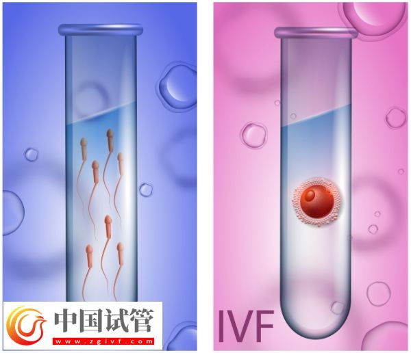 囊胚等級與寶寶健康之間有關系嗎?(圖5) 囊胚等級與寶寶健康之間有關系嗎?(圖5)