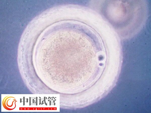 哪些人可以做胚胎輔助孵化(圖1) 哪些人可以做胚胎輔助孵化(圖1)