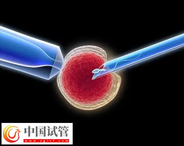 做試管嬰兒出現(xiàn)腹水的原因是什么(圖1) 做試管嬰兒出現(xiàn)腹水的原因是什么(圖1)