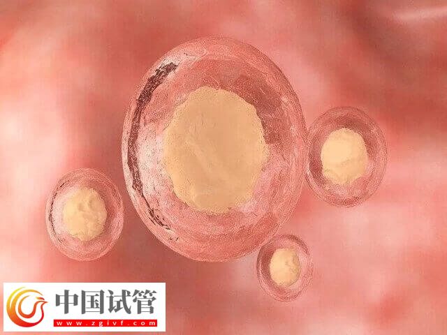 取卵后多余的卵會不會自己排掉(圖1) 取卵后多余的卵會不會自己排掉(圖1)