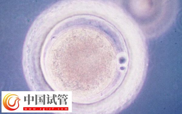 一級胚胎是不是很難得(圖1)