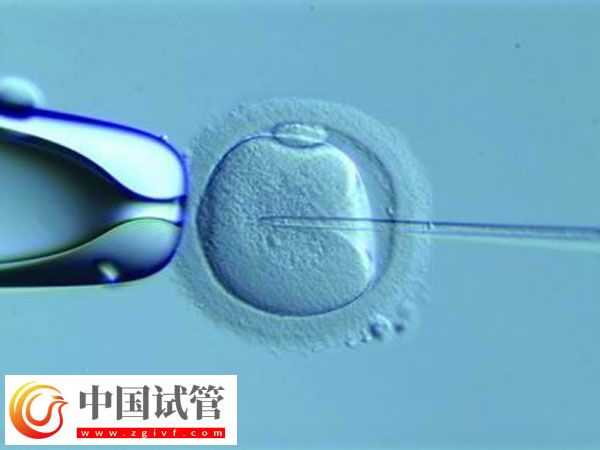 泰國(guó)試管嬰兒能活多久(圖1) 泰國(guó)試管嬰兒能活多久(圖1)