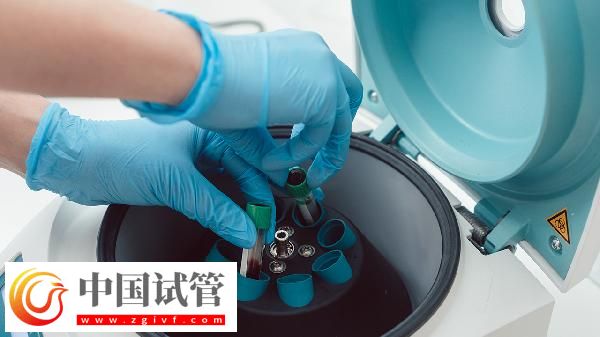 血常規(guī)五項是哪五項(圖3)