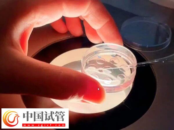 囊胚移植第十九天出血怎么回事(圖1)