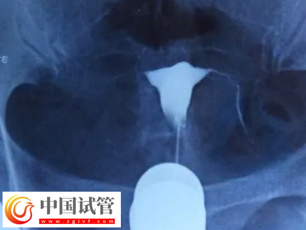 北京試管嬰兒要什么證件(圖2)