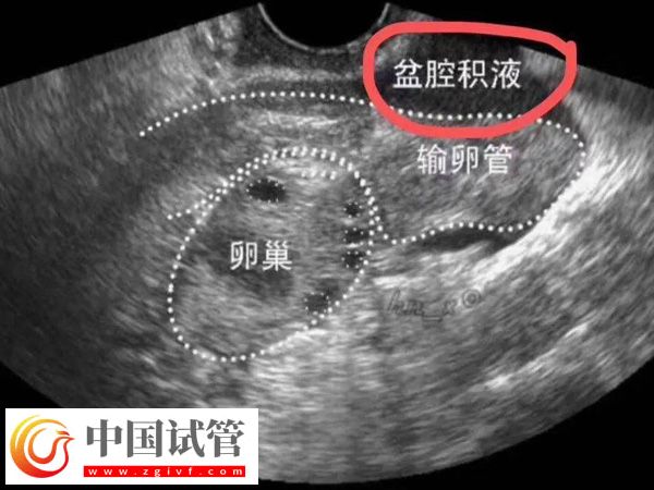 2025在西班牙做試管嬰兒需要什么條件(圖4) 2025在西班牙做試管嬰兒需要什么條件(圖4)