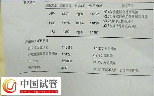 HCG值能不能看出單胎還是雙胎(圖1)