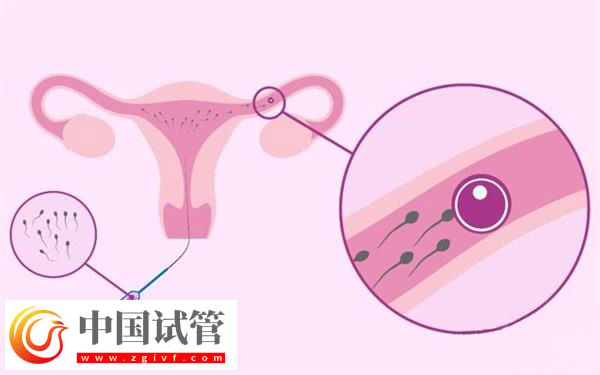 在武漢協(xié)和醫(yī)院申請(qǐng)供精能做幾次(圖3) 在武漢協(xié)和醫(yī)院申請(qǐng)供精能做幾次(圖3)