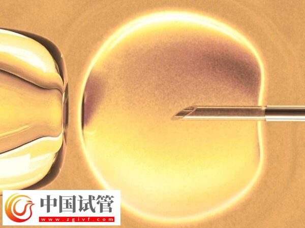 卵泡期長(zhǎng)方案適合哪些人(圖1) 卵泡期長(zhǎng)方案適合哪些人(圖1)