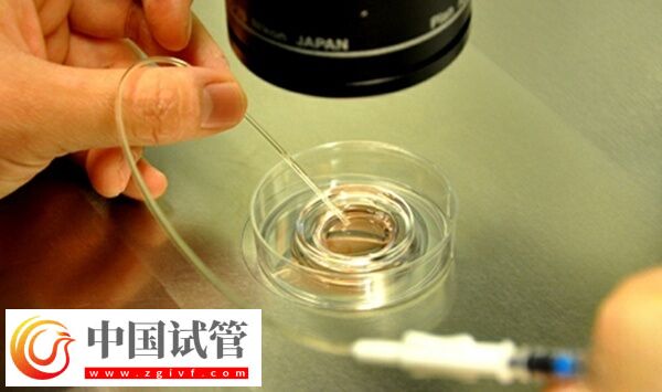 8c胚胎養(yǎng)囊成功率多少(圖1) 8c胚胎養(yǎng)囊成功率多少(圖1)