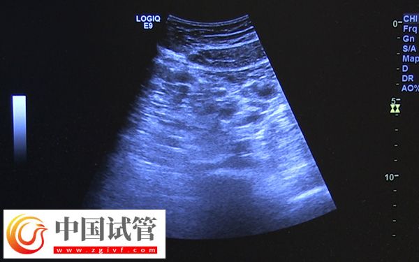 咸寧市中心醫(yī)院監(jiān)測卵泡多少錢(圖1) 咸寧市中心醫(yī)院監(jiān)測卵泡多少錢(圖1)