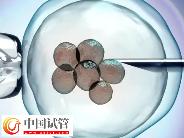 湘雅和武漢試管哪家好(圖1)