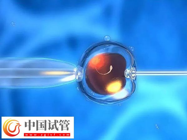 杭州省婦保醫(yī)院和市一醫(yī)院做試管哪個(gè)好(圖2) 杭州省婦保醫(yī)院和市一醫(yī)院做試管哪個(gè)好(圖2)