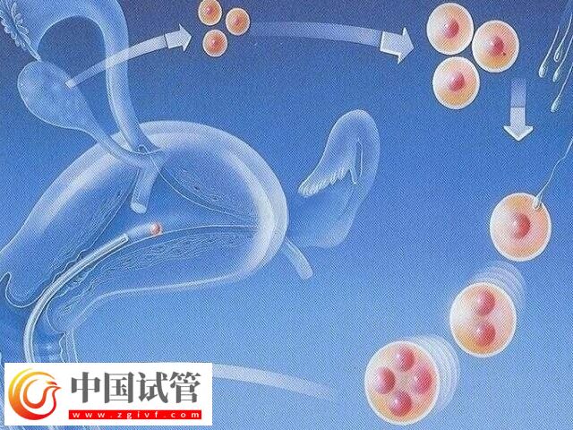 試管嬰兒不適用于哪些人(圖1) 試管嬰兒不適用于哪些人(圖1)