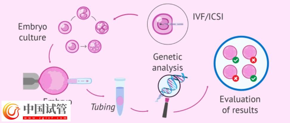 基因與第三代試管嬰兒的結(jié)合