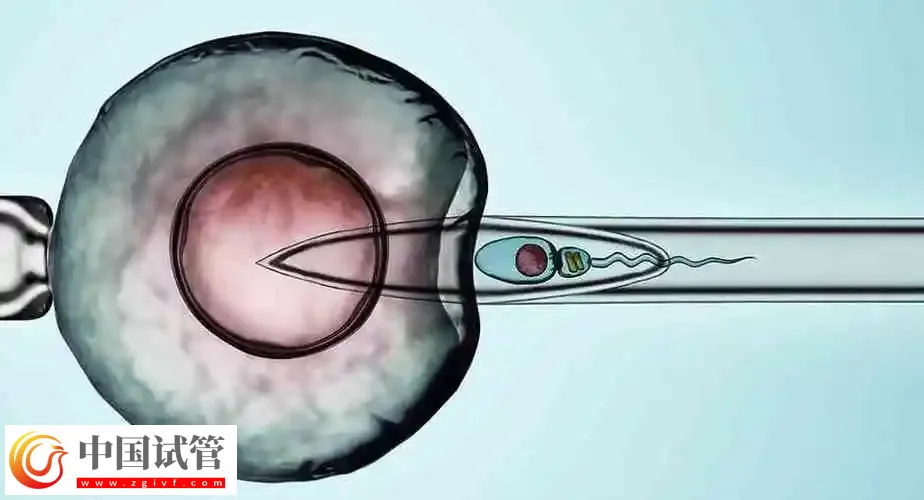 濟南做試管嬰兒成功率較高的醫院前三名:濟南第一人民醫院排第一(圖3) 濟南做試管嬰兒成功率較高的醫院前三名:濟南第一人民醫院排第一(圖3)