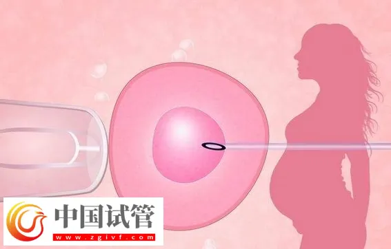 廣州哪家做試管嬰兒可以包懷上的？首選中山大學附屬第一醫院(圖3)