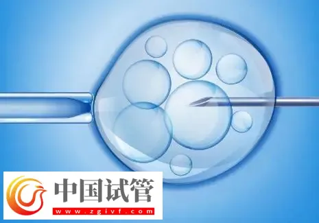 濟南2025試管助孕代/懷產子機構名單,附流程與費用介紹(圖1) 濟南2025試管助孕代/懷產子機構名單,附流程與費用介紹(圖1)