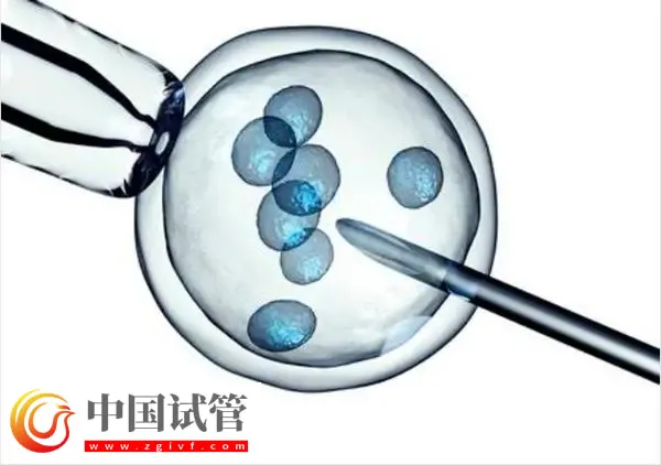 青島做試管最好的醫院top10名單匯總:青島大學附屬醫院位列榜首(圖1) 青島做試管最好的醫院top10名單匯總:青島大學附屬醫院位列榜首(圖1)