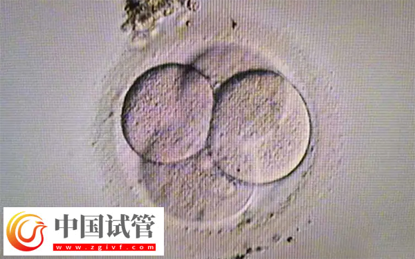 FSH高做試管是否需要吃補佳樂降FSH建議以醫(yī)務工作人員的囑咐為準,因為每個患者的身體狀態(tài)不同,能否服用該藥物也是不一樣的,但要注意,該藥物確實可以幫助調節(jié)激素水平,改善卵巢功能以及增加卵子質量等方式發(fā)揮作用,有助于降低FSH數(shù)值并提高雌二醇的含量。只是有一點要引起重視,這通常需要在醫(yī)生的指導下進行,確保用藥的劑量和時間正確無誤。 補佳樂可以調節(jié)激素水平 FSH高做試管是否需要吃補佳樂降FSH(圖3) 女性fsh高做試管能不能配出高質量胚胎(圖3)