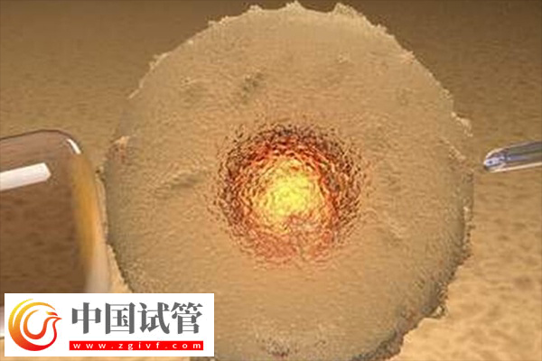 前往俄羅斯做試管合不合法(圖1)