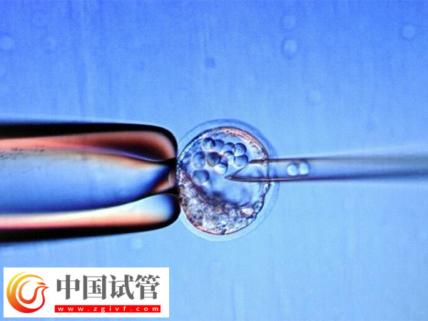 為什么俄羅斯試管成功率那么高(圖2)