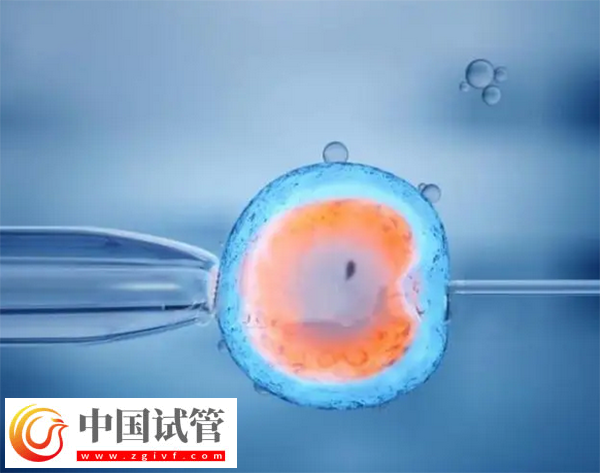 上海試管嬰兒成功率(圖1)