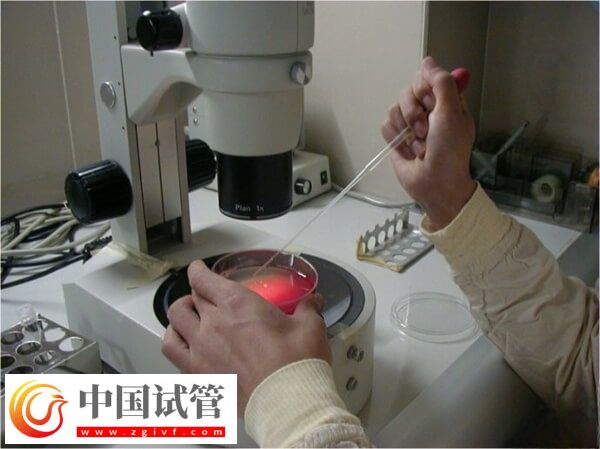 試管嬰兒能否一次移植成功(圖1)