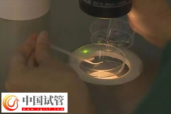 做試管一般取卵幾個(gè)(圖2) 做試管一般取卵幾個(gè)(圖2)