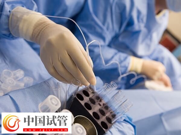 做試管嬰兒的時間怎么安排(圖1)