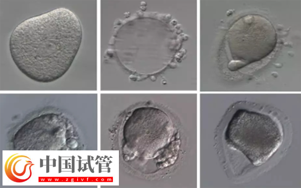 女性內膜13b是否可以移植囊胚胚胎(圖3)