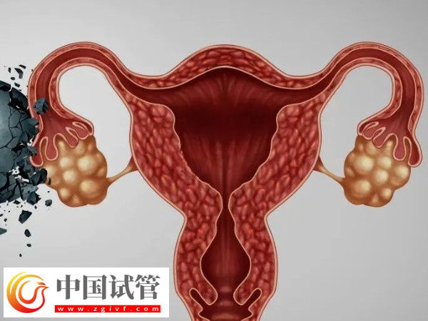 夫妻去美國做試管怎么選擇醫院(圖5) 夫妻去美國做試管怎么選擇醫院(圖5)