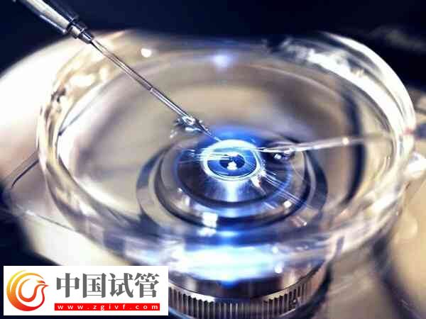 取卵后一個月卵巢是否恢復了(圖2)