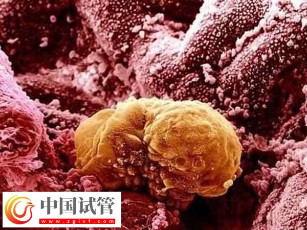 卵巢早衰amh值0.08試管能不能成功(圖1) 卵巢早衰amh值0.08試管能不能成功(圖1)