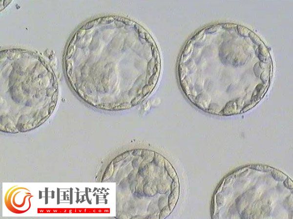 移植囊胚和三天胚胎是否一樣(圖1) 移植囊胚和三天胚胎是否一樣(圖1)