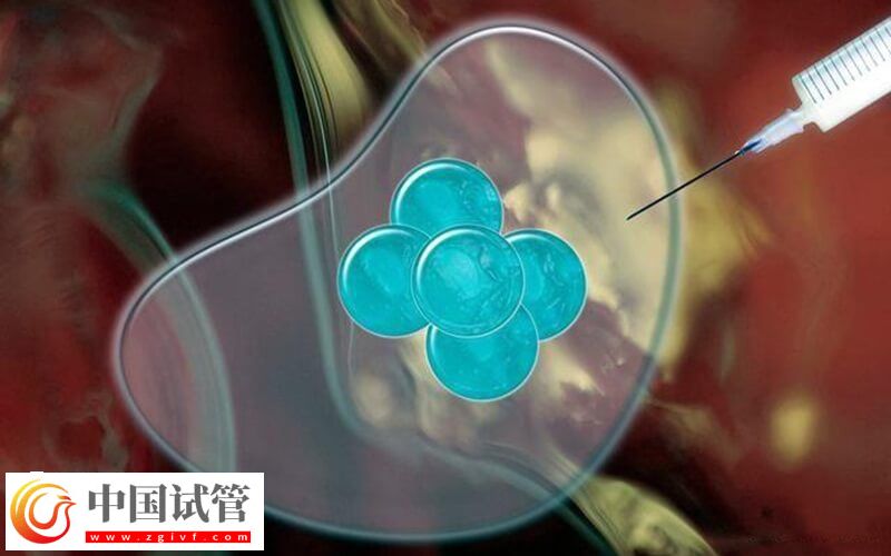 吉安市婦幼保健院人工授精的治療流程是怎么樣的?(圖2) 吉安市婦幼保健院人工授精的治療流程是怎么樣的?(圖2)