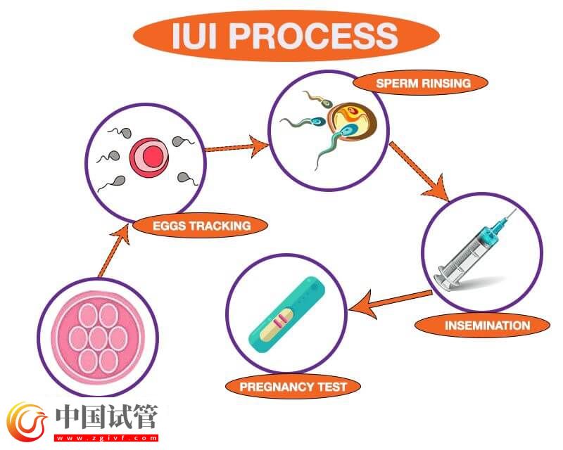 吉安市婦幼保健院人工授精的治療流程是怎么樣的?(圖1) 吉安市婦幼保健院人工授精的治療流程是怎么樣的?(圖1)