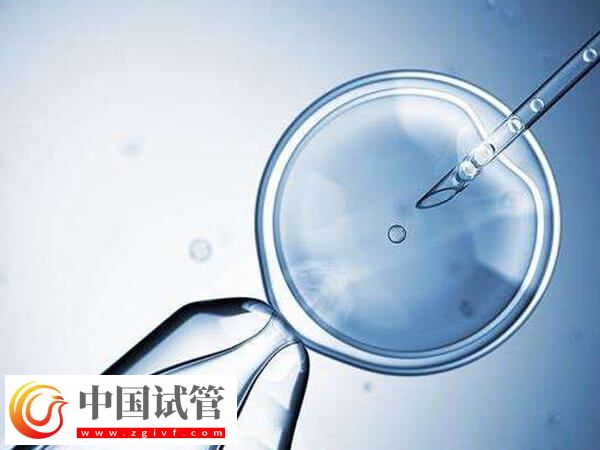 多囊卵巢想懷孕？這份鄭州治療醫院、手術專家指南請收好(圖1)