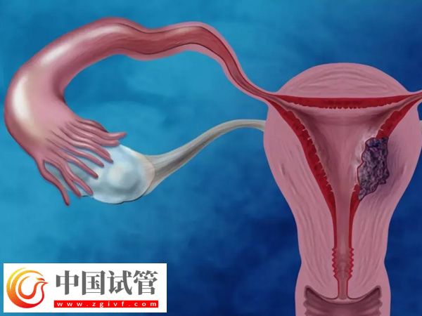 攀枝花試管醫院哪家好(圖2)